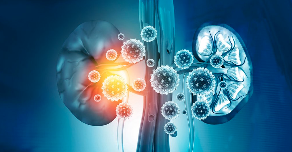 Managing Kidney Disease: Expert Tips for a Healthier Lifestyle